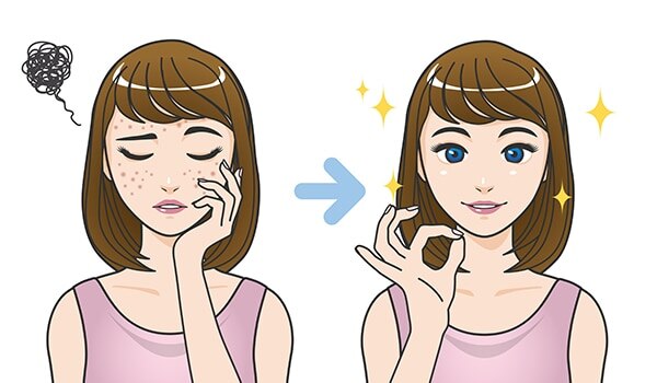 11 Home Remedies To Tackle Skin Pigmentation Around The Mouth