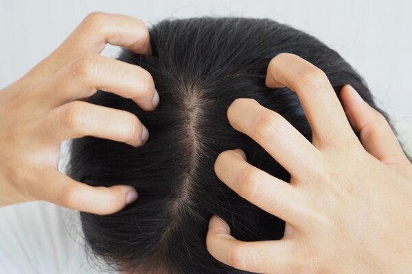 FAQs on jojoba oil for hair FAQs on jojoba oil for hair