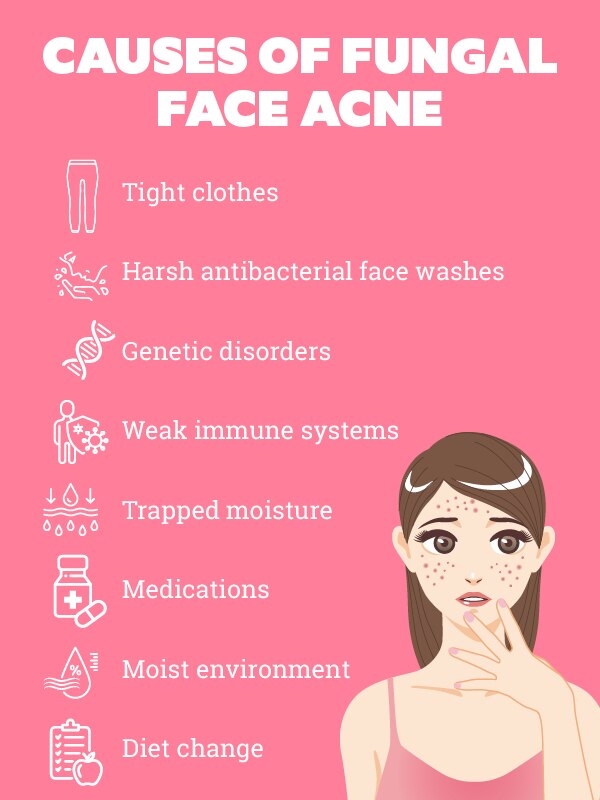 How to treat fungal face acne? How to treat fungal face acne?