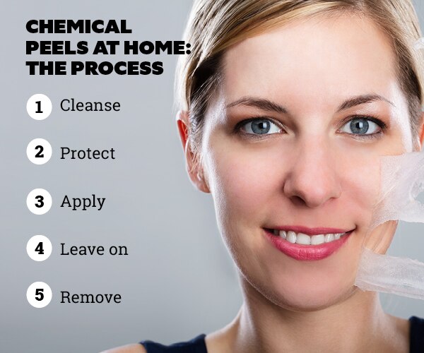 FAQs on chemical peels at home: FAQs on chemical peels at home: