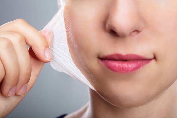 FAQs on chemical peels at home: FAQs on chemical peels at home: