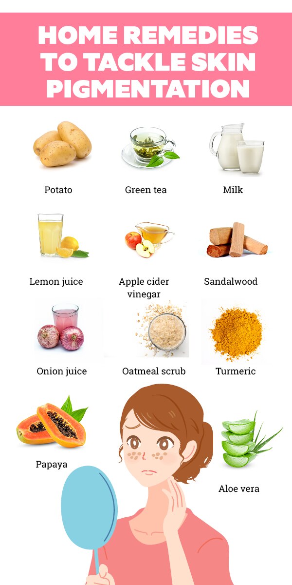 FAQs about skin pigmentation FAQs about skin pigmentation