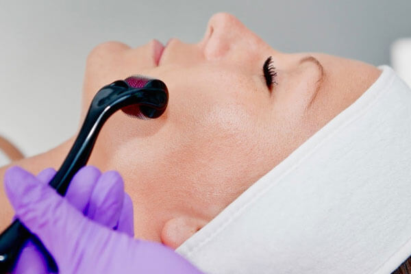 How does microneedling work? How does microneedling work?
