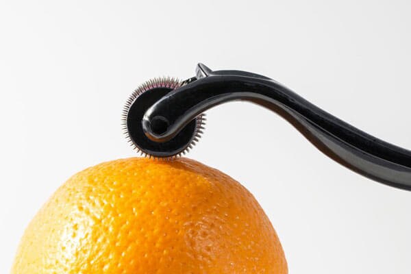 How does microneedling work? How does microneedling work?