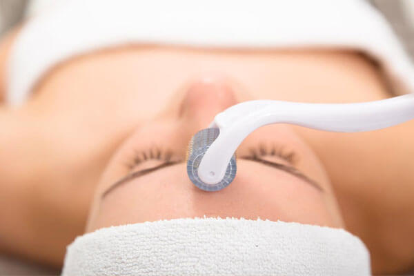 How does microneedling work? How does microneedling work?
